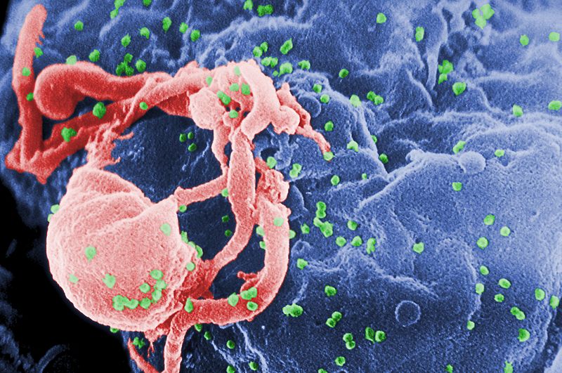 Передается ли вирус при оральном сексе? Когда не нужна защита? 9 вопросов о сексе и ВИЧ